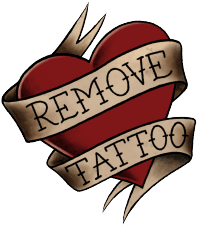 Remove Tattoo - Få fjernet din tattovering sikkert og effektivt til markedets billigste priser